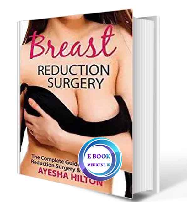 دانلود کتاب Breast Reduction Surgery: The Complete Guide to Breast Reduction Surgery & Recovery2019 ( PDF)